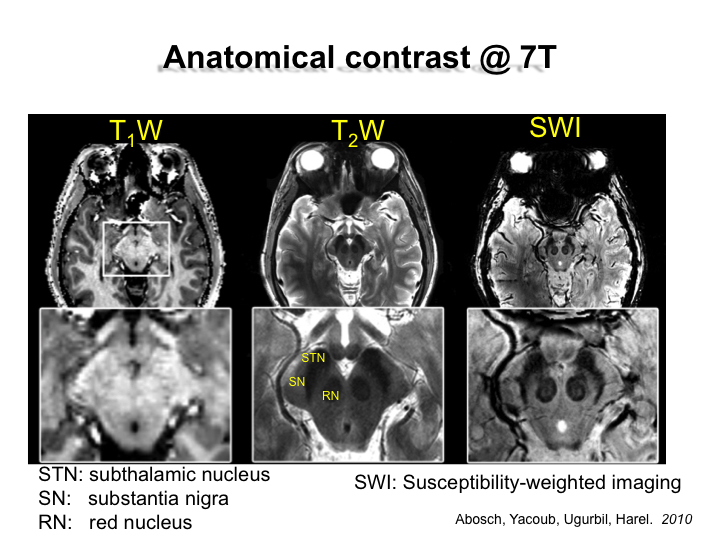 Anatomical Contrast @ 7T