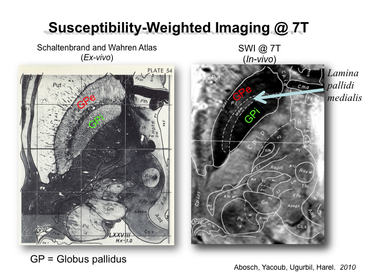 Susceptibility-Weighted Imaging @ 7T